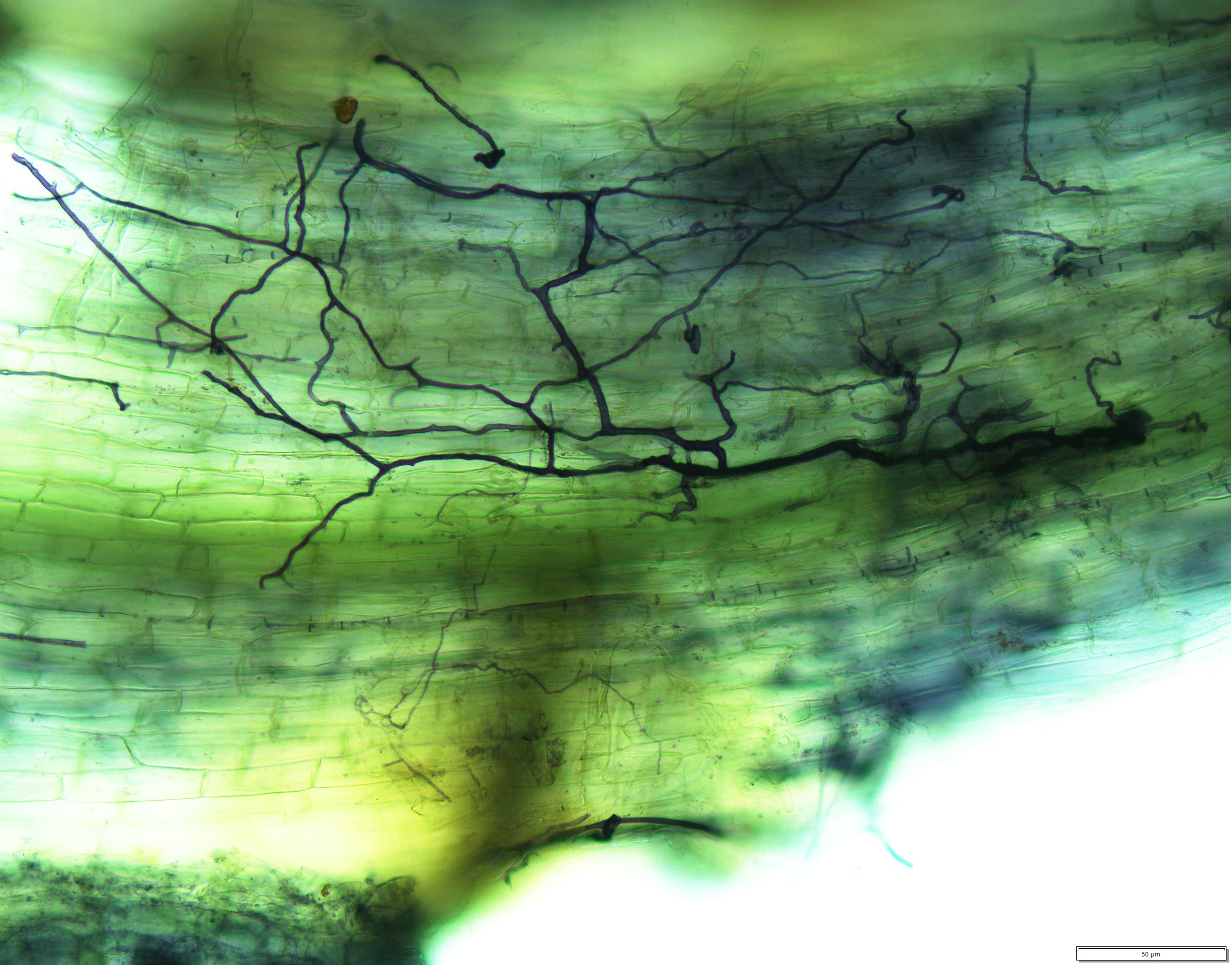 Arbuscular mycorrhizal hyphae