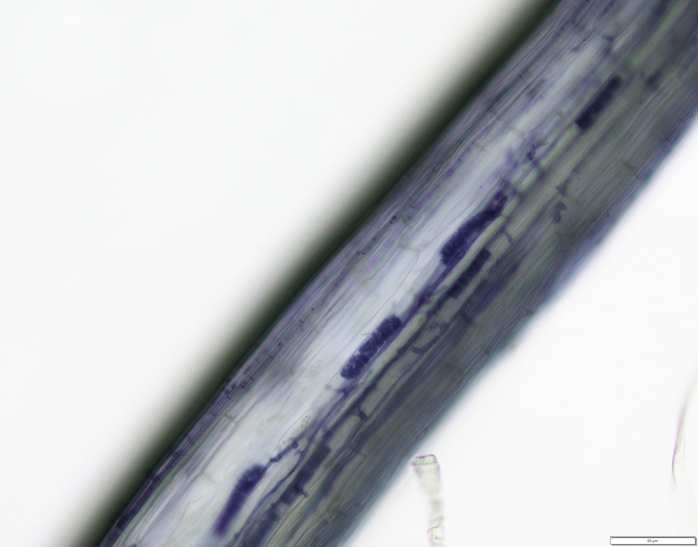 Arbuscule under microscopy